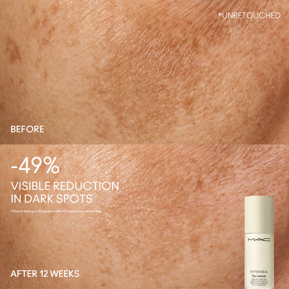 Hyper Real Serumizer™ Skin Balancing Hydration Serum, 15.0 ml, Model, medium
