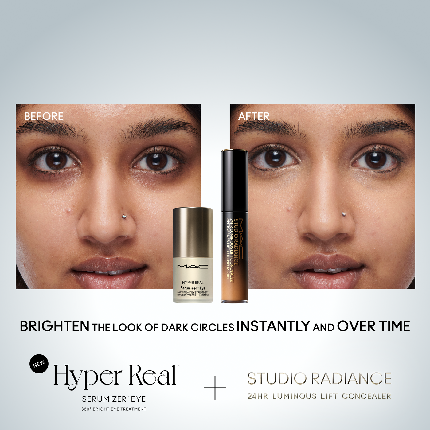 Hyper Real Serumizer™ Eye 360° Bright Eye Treatment, 15.0 ml, Alt