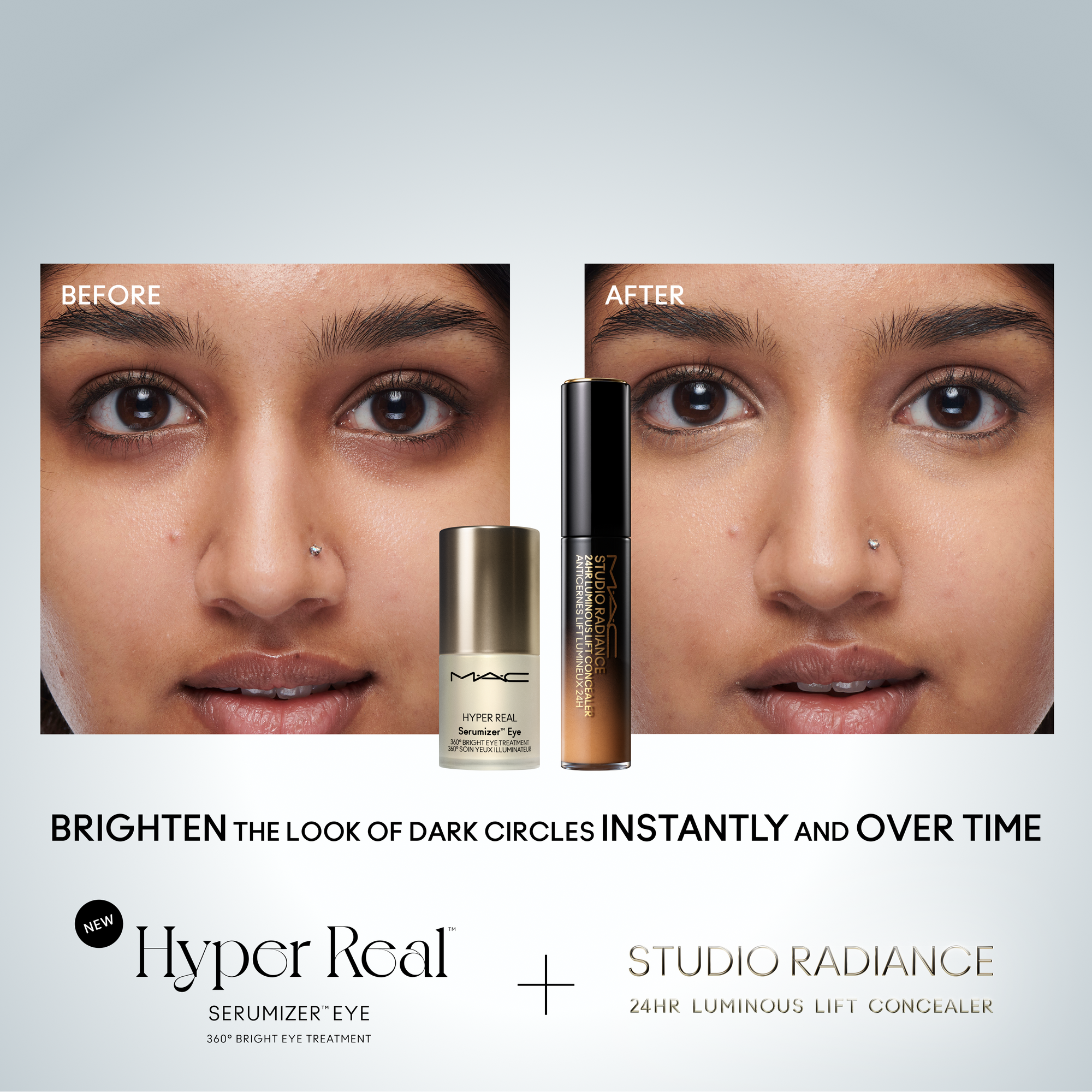 Hyper Real Serumizer™ Eye 360° Bright Eye Treatment, 15.0 ml, Alt